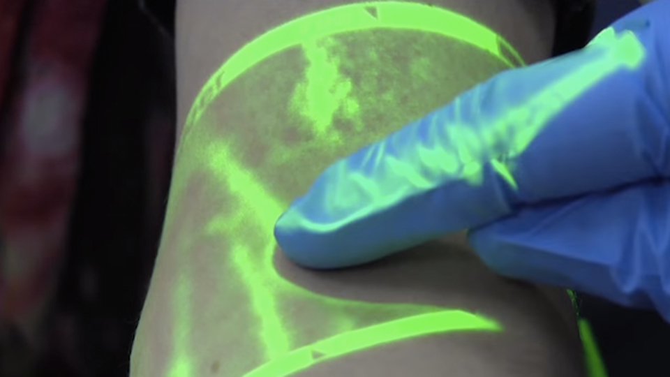 feixe-de-luz-encontra-veia